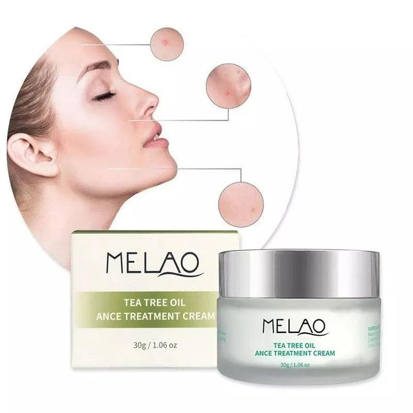 Melao Acne Treatment Cream:-30 gm - BlushyLady