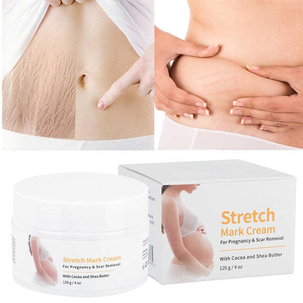 Melao Stretch Mark Cream:-120 gm - BlushyLady